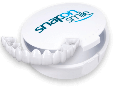 виниры snap-on-smile