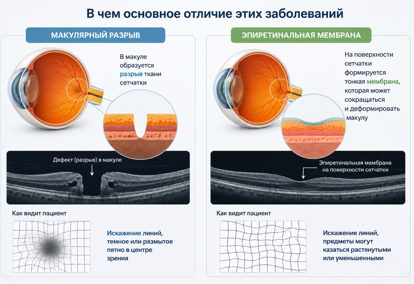 В чем основное отличие этих заболеваний