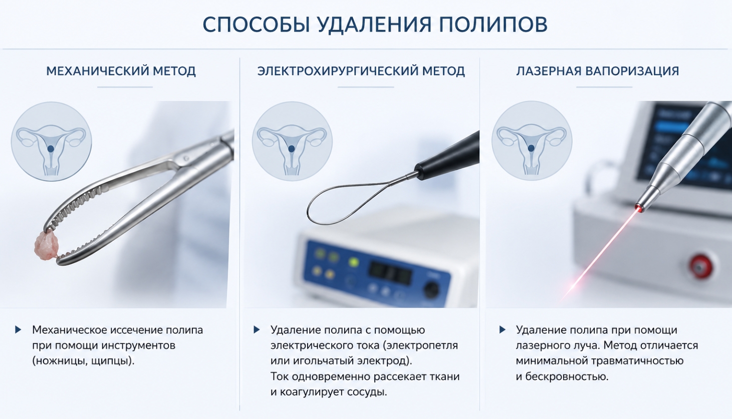 Способы удаления